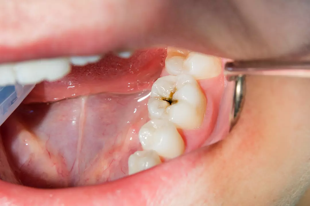 Odontologie Conservatrice - Centre Dentaire Benhayoune Tanger
