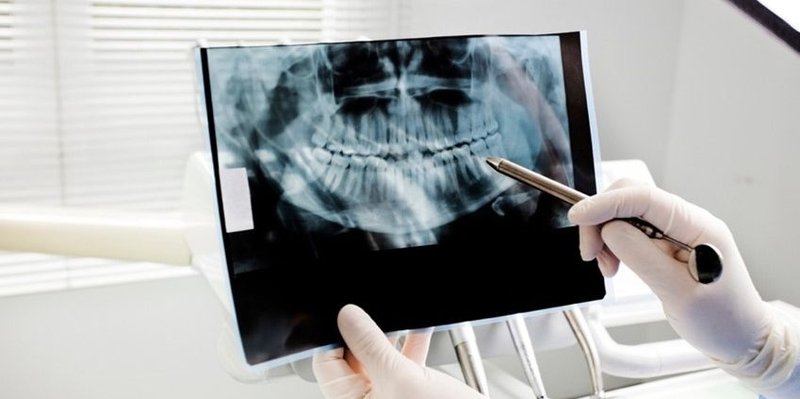 Radiographie Dentaire - Centre Dentaire Benhayoune Tanger